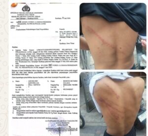 Madas Sedarah Advokasi Tiga Anak Dianiaya Bulak Rukem Surabaya.