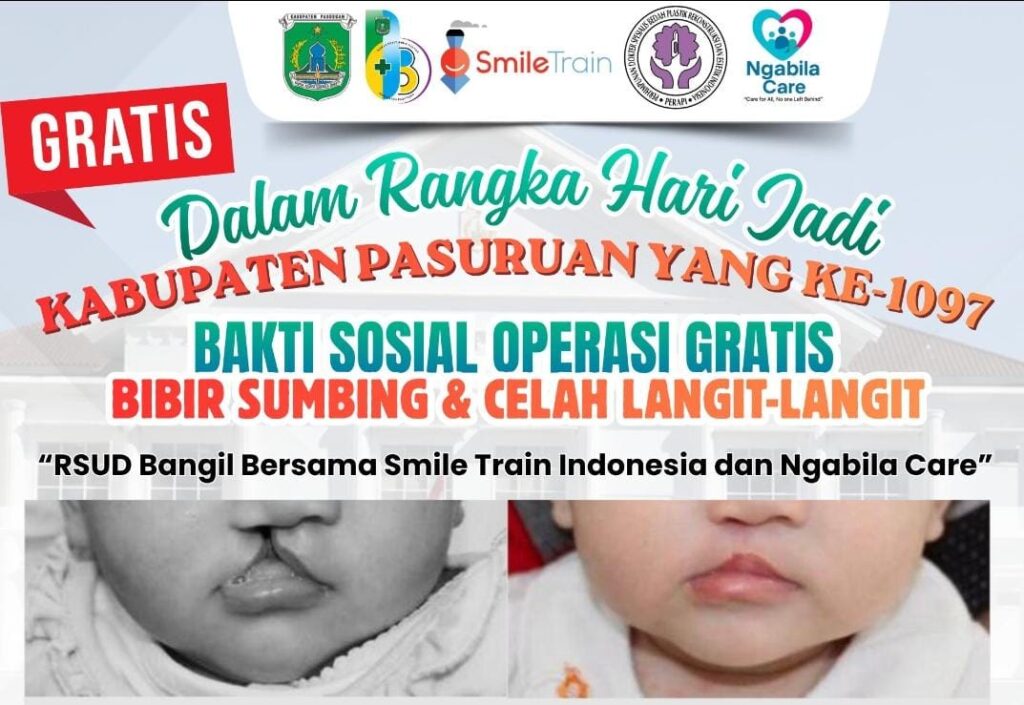Rayakan HUT ke-1097, Pemkab Pasuruan Gelar Operasi Gratis Bibir Sumbing dan Celah Langit-Langit*
